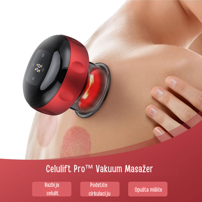 Celulift Pro Vakuum Masažer
